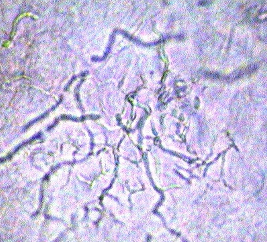 マラセチア 顕微鏡 画像