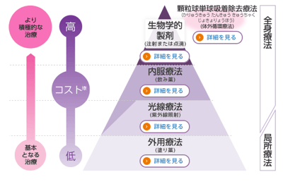 乾癬の治療法