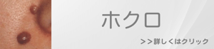 福岡でのほくろ除去