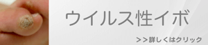 ウイルス性イボの治療のご案内