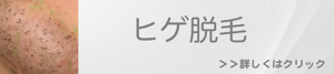 福岡で行うヒゲ脱毛