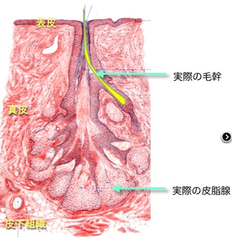 脂腺毛包