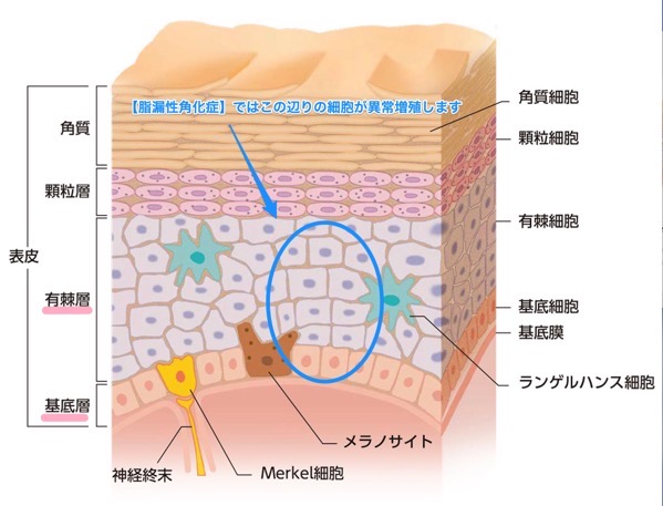 皮膚の構造