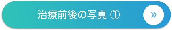 トータルケアコース写真1