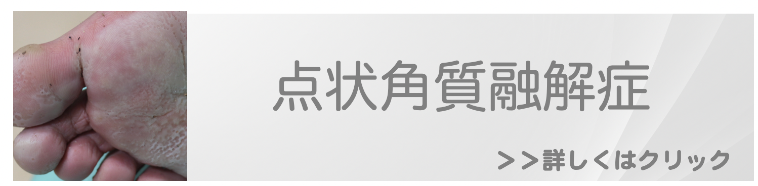点状角質角質融解症