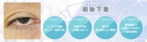 福岡の形成外科による眼瞼下垂
