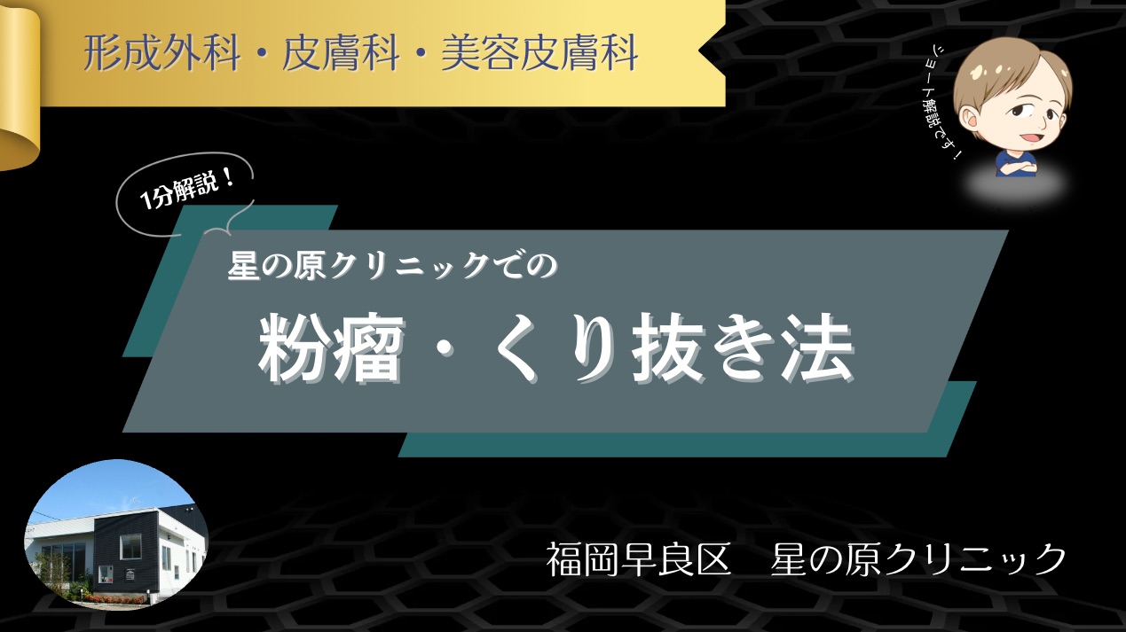 粉瘤 くり抜き法　福岡