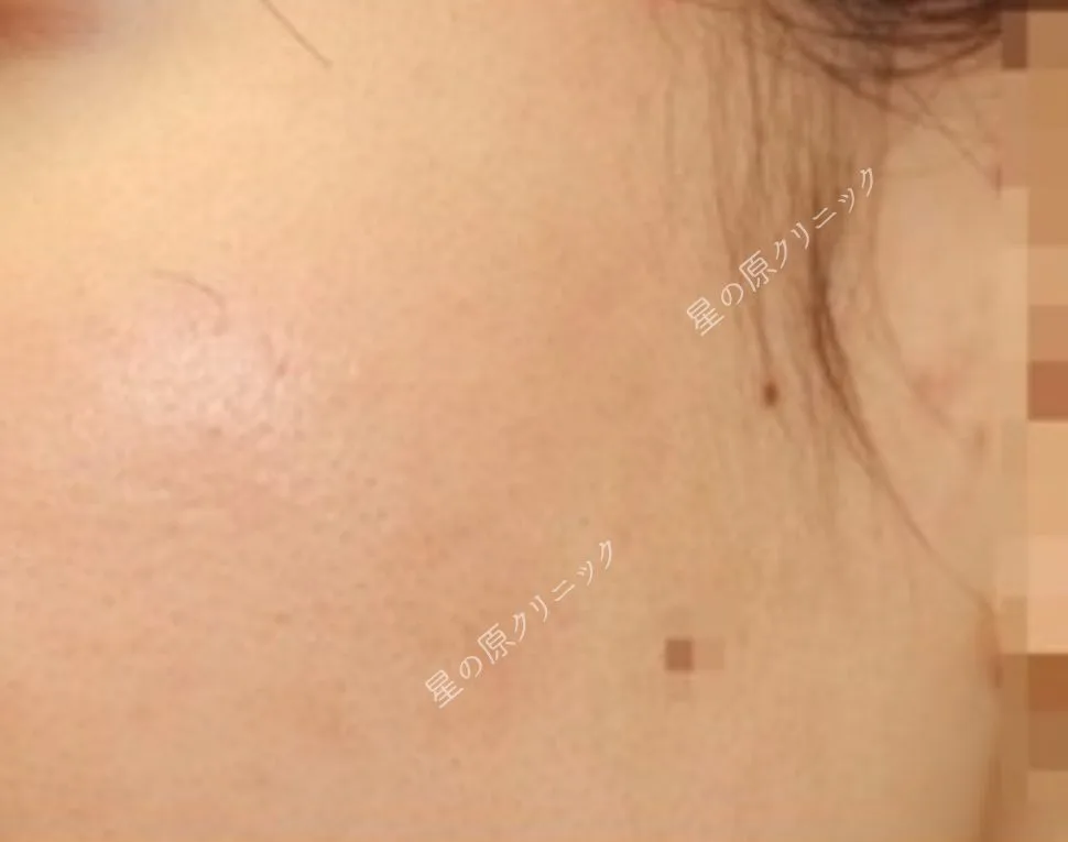 After