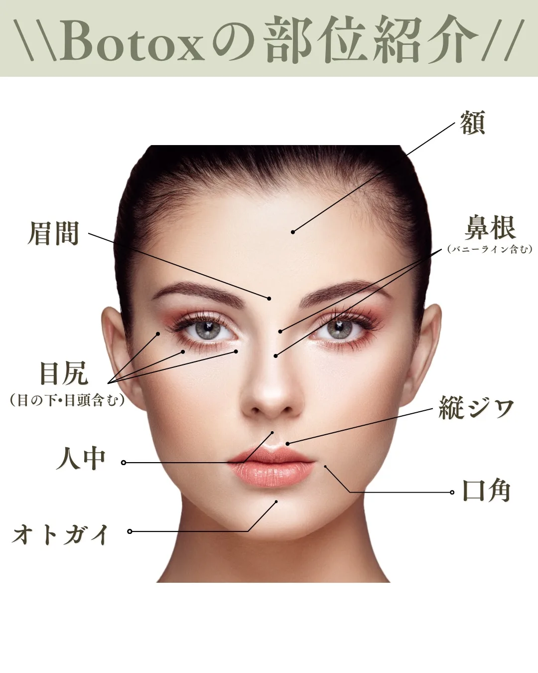 ボトックスキャンペーン