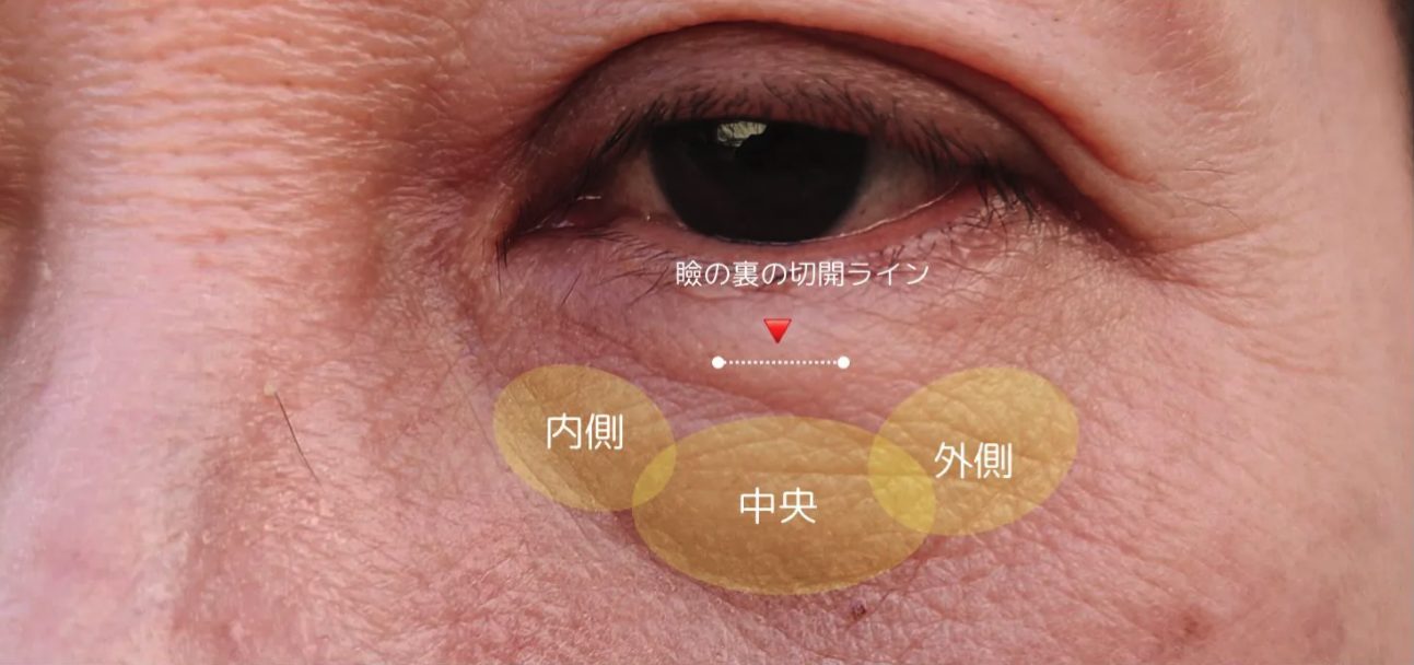 UntitledImage.png UntitledImage