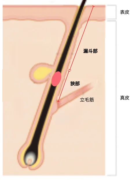 粉粒の穴