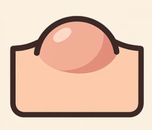 粉瘤穴なし