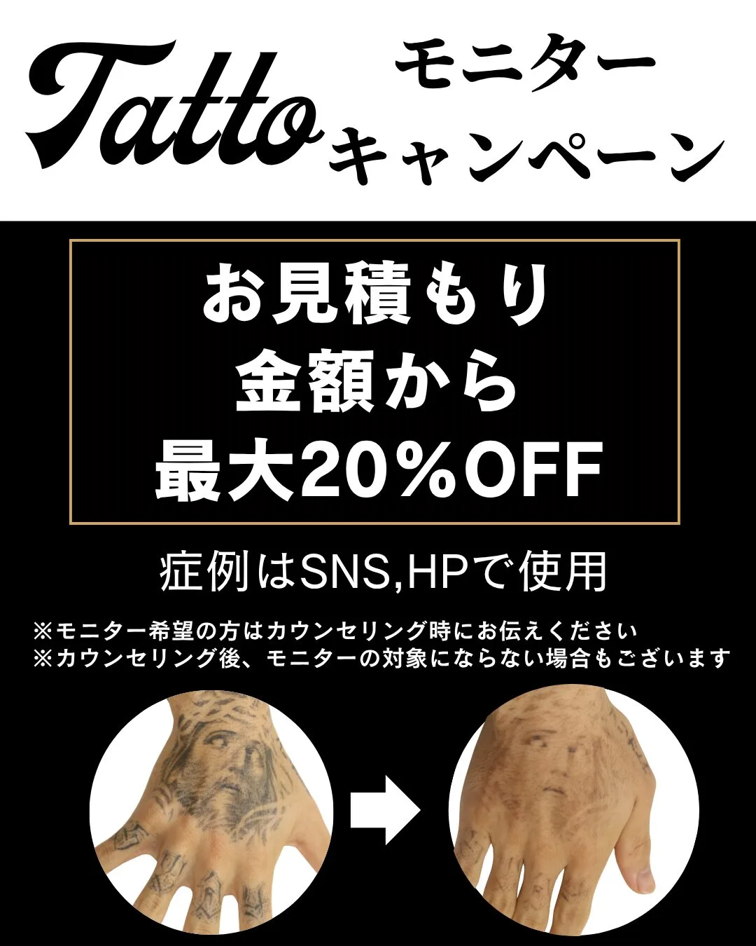 タトゥーモニター