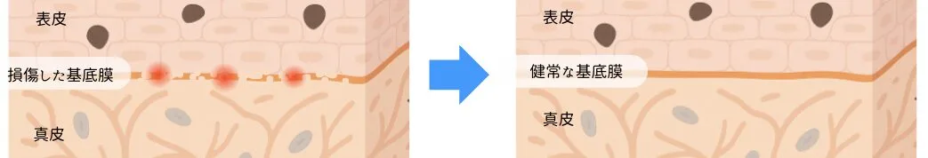 福岡肝斑治療.png 福岡肝斑治療