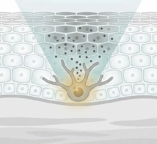 福岡肝斑治療.png 福岡肝斑治療