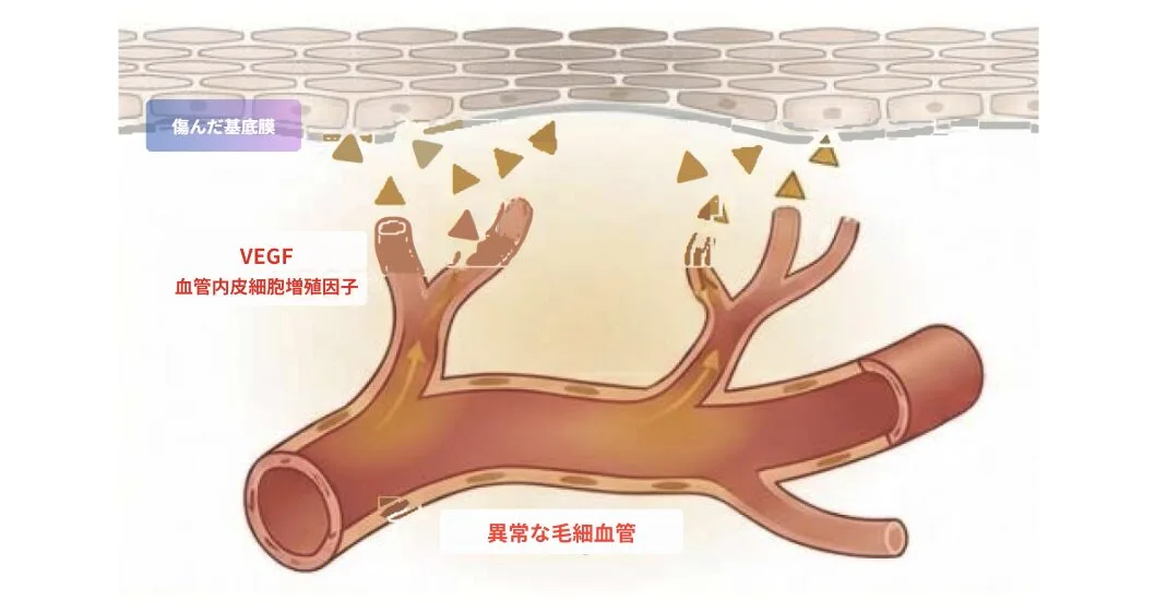 福岡肝斑治療2.png 福岡肝斑治療2