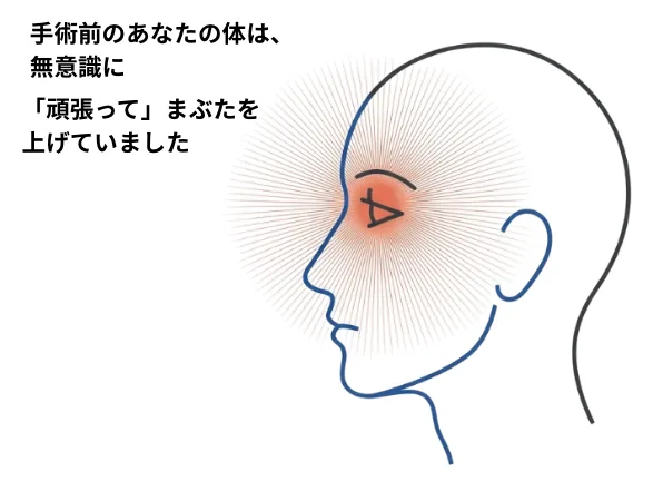 福岡、眼瞼下垂