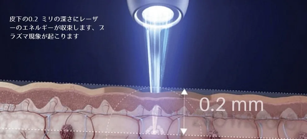 福岡レーザー治療・リゾルブ.png 福岡レーザー治療・リゾルブ